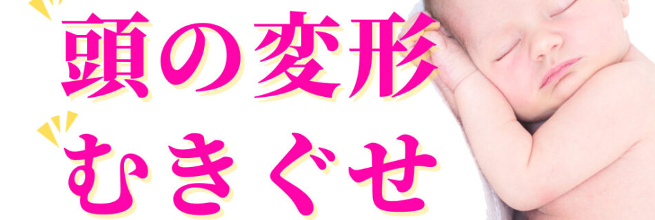 赤ちゃん整体　頭の変形　向きぐせ　便秘　ヘルメット治療